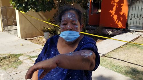 SALVAN A ABUELA Y NIETA DE MORIR EN INCENDIO