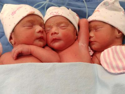 Nacen trillizas idénticas en el HIMES