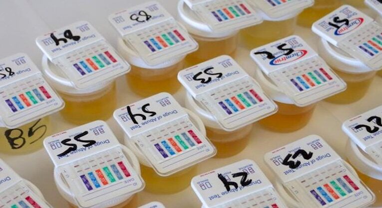 Realizan antidoping a policías de Cajeme