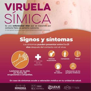 Confirma Secretaría de Salud tener caso positivo de viruela símica