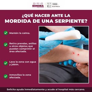 Llama Secretaría de Salud a prevenir afectaciones por mordedura de serpiente